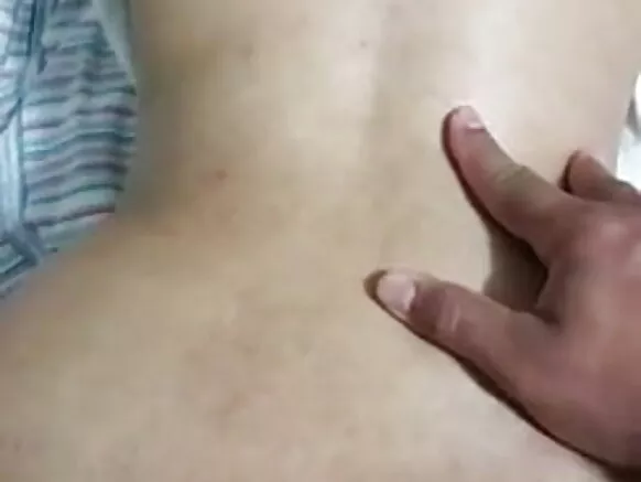 En prolapso anal warmi, warmipa culo.