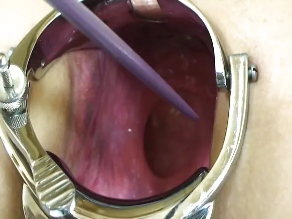 Elmerpa warminmanta ñawpaq extremo wasiy anal - anal gaping! -imaynata1.